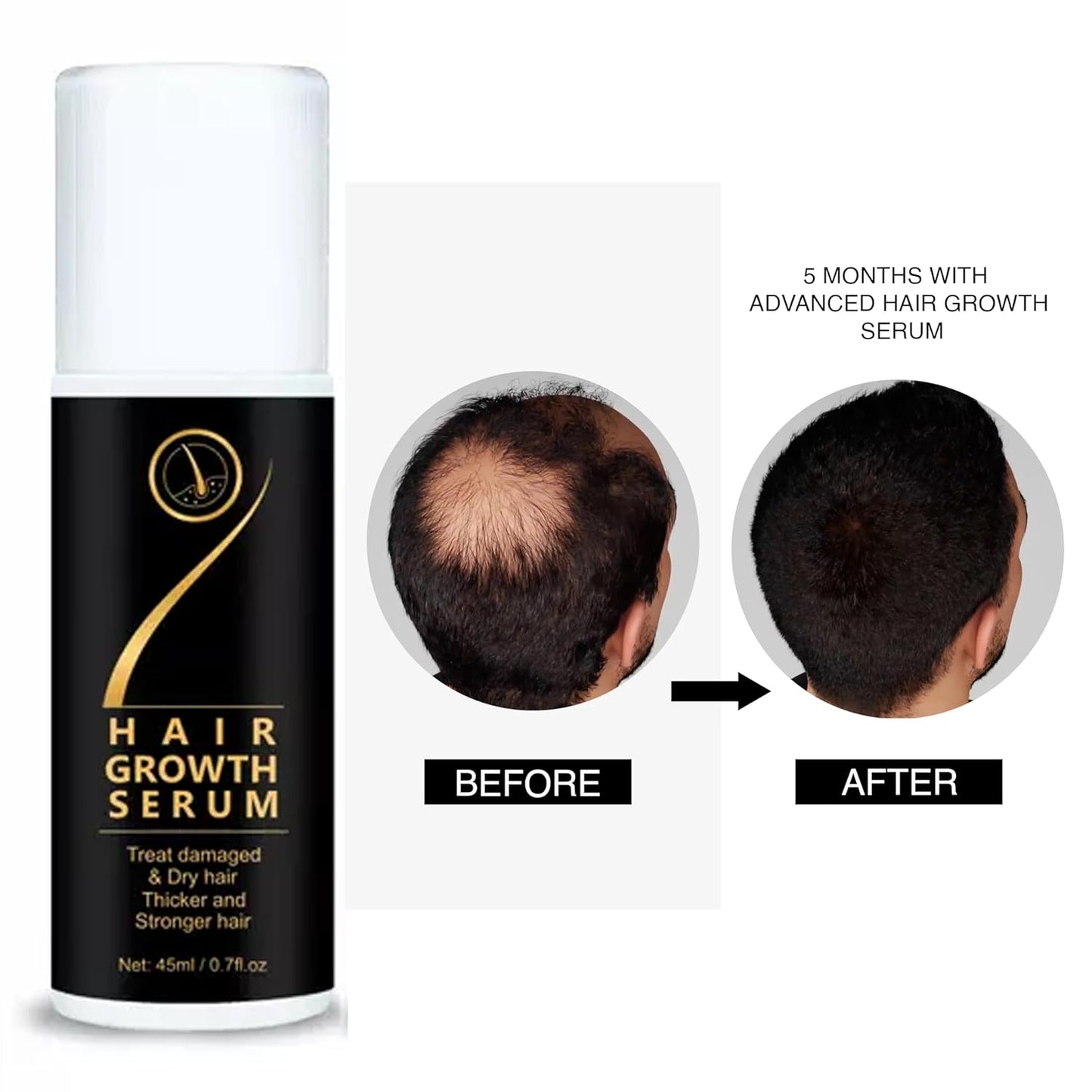 Hair Growth Serum