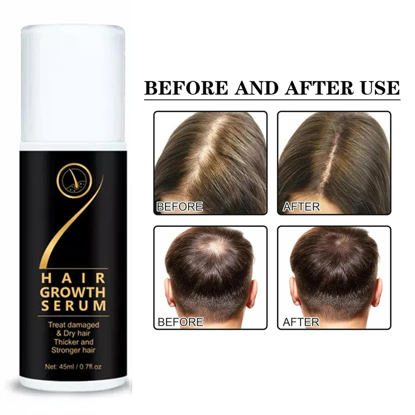 Hair Growth Serum