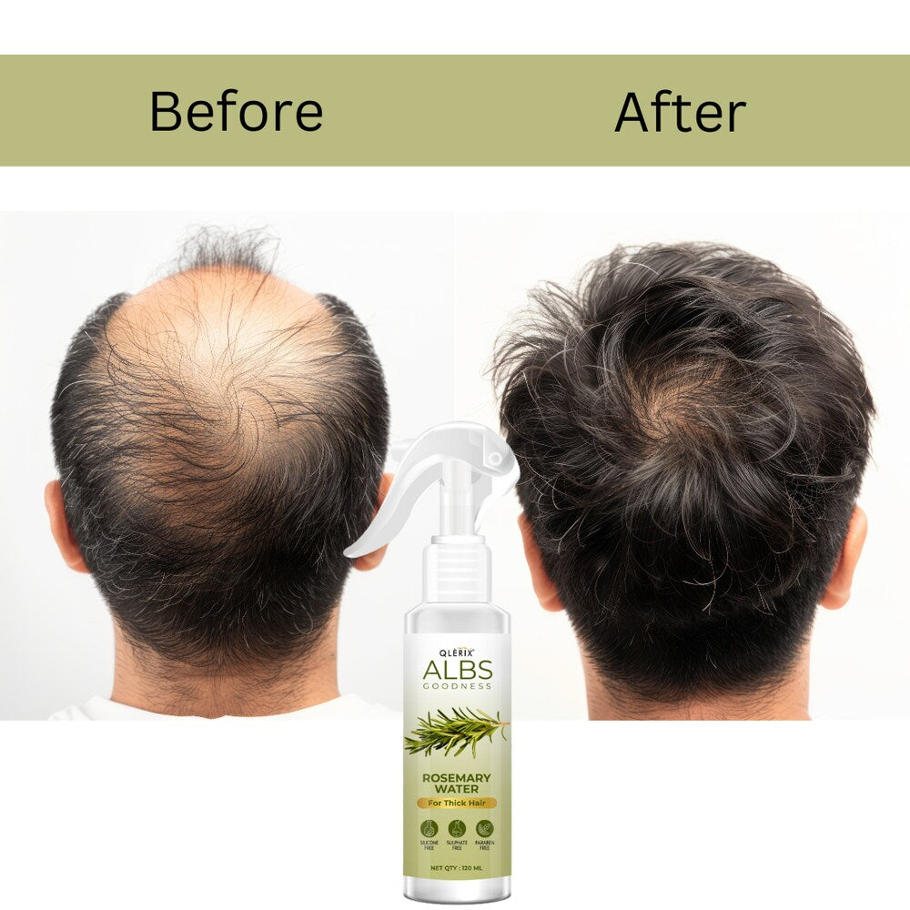 Rosemary Water Spray For Hair Growth ( Pack Of 3 )